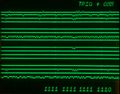 Timing diagram with mainframe readout